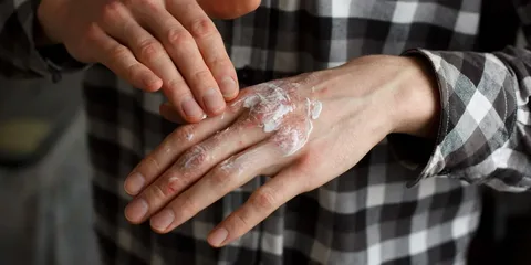 Sədəf xəstəliyi üçün dəstək qrupu: Sizə uyğun olduğunu göstərən 5 əlamət