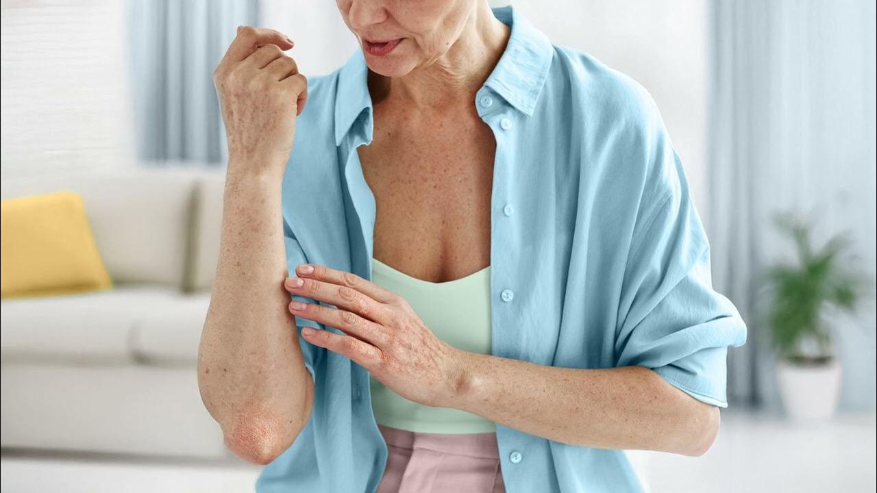 Psorias müalicəsi: Qaşıntılı dəri üçün 6 effektiv yol